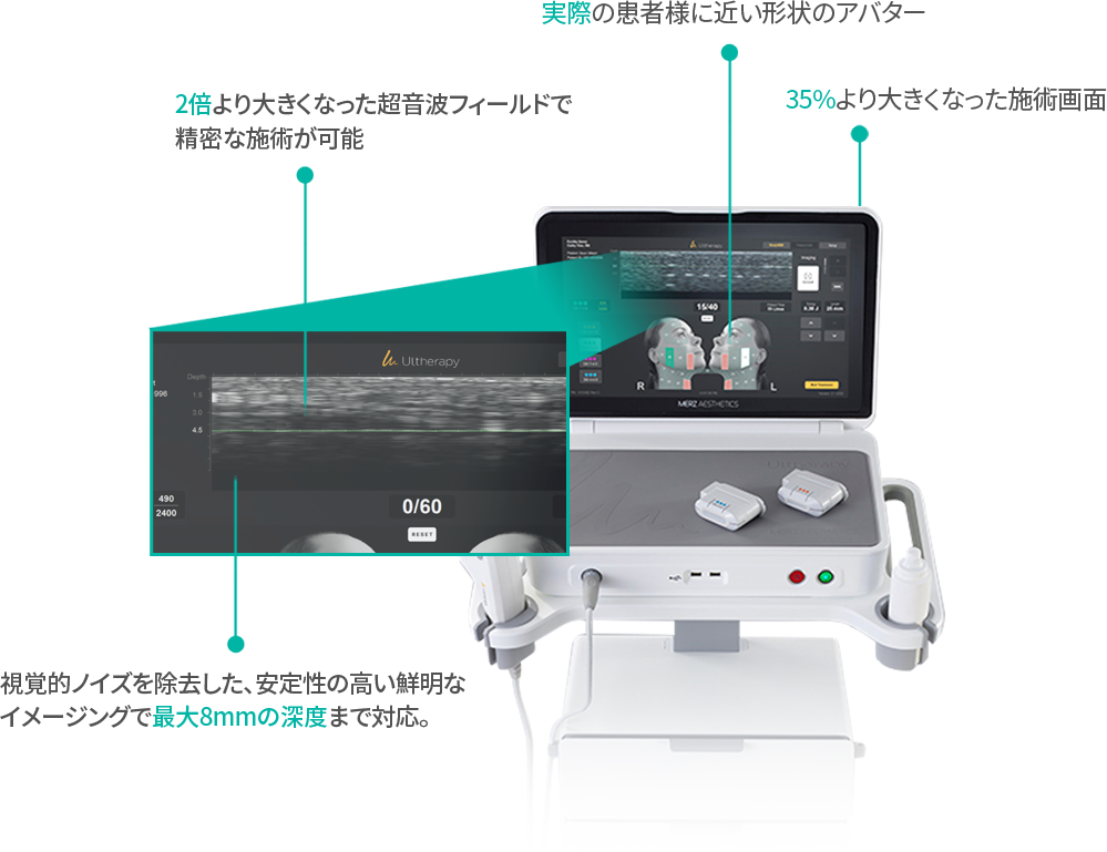 ultheraprime image
