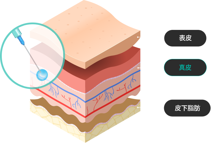 Treatment process image