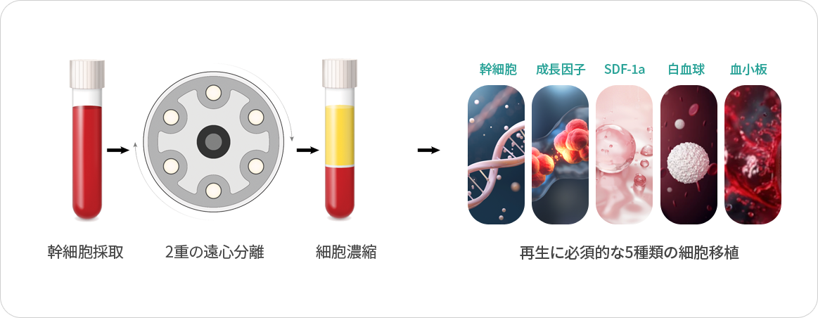 自家血スキンブースター PROCESS image